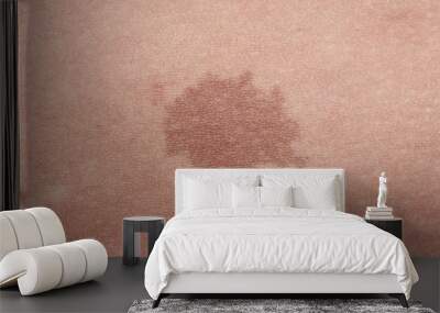 Close-up of brown birthmark Wall mural