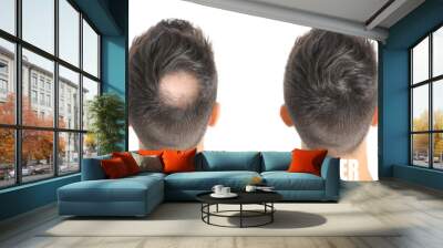 Man before and after hair loss treatment on white background Wall mural