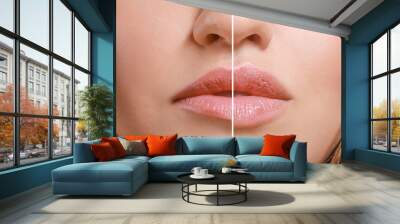 Young woman before and after lip enhancement, closeup Wall mural