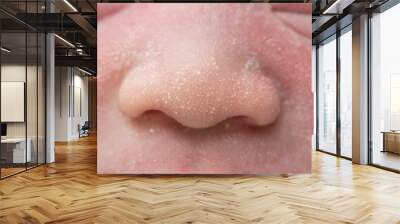 Macro, close-up shot of the milia on a two day old baby cheek, nose and forehead. Wall mural