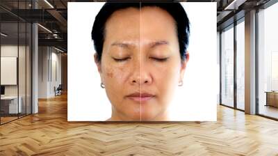 Retouched image to show before and after treatment spot melasma pigmentation facial treatment on young asian woman face. Skincare and health problem concept. Wall mural