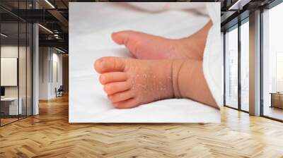 Closeup instep or foot of a newborn with a skin peeling on white cloth. Skin allergies in newborn called Vernix. the concept of health care and medical. Wall mural