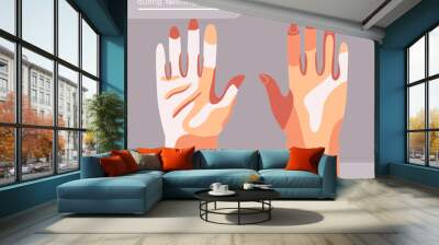 Flat style vector illustration of Area most often missed during washing hands infographic. Concept of how to cleaning hands to avoid germs and virus.  Wall mural