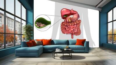 Gallstones in the Gallbladder, human silhouette and anatomy of surrounding organs. Wall mural