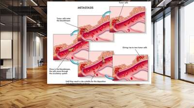 metastasi Wall mural