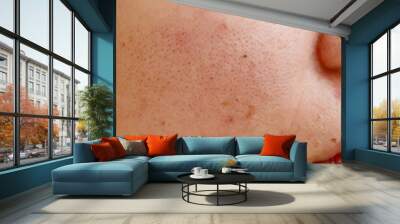 acne on the woman face Wall mural