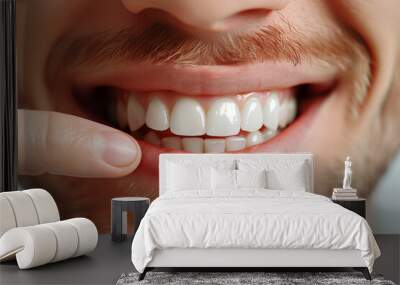 Closeup of a man smiling showing beautiful teeth. Wall mural