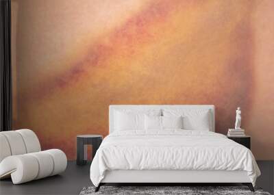 Closeup bruise on human skin as a background. Wall mural