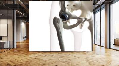 3d rendered medically accurate illustration of a hip replacement Wall mural