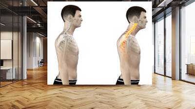 3d rendered medically accurate illustration of a man with a forward head posture Wall mural