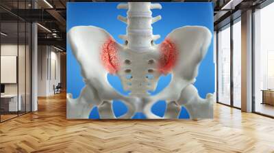 3d rendered medically accurate illustration of an arthritic iliosacral joint Wall mural