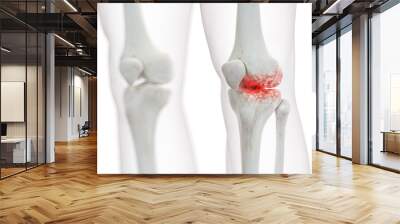 3d rendered medically accurate illustration of an arthritic knee joint Wall mural