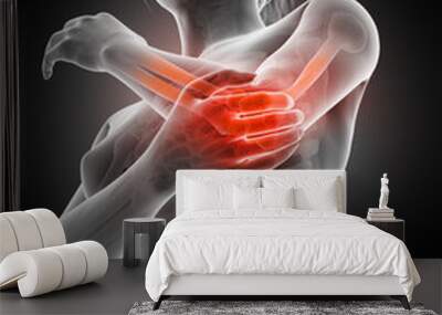 woman having acute pain in the elbow joint Wall mural