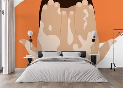 Fair skin hands with vitiligo depigmentation. World vitiligo day concept. Vector illustration. Wall mural