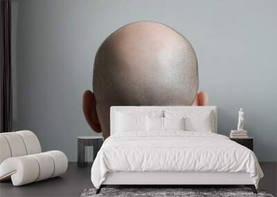 Medical Background. Young Adult Bald Man with Hair Loss Problem, Health Care Concept Wall mural