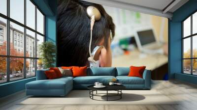 Cochlear implant on the head Wall mural