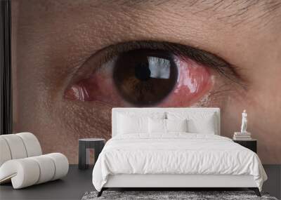 Human's red eye conjunctivitis Wall mural