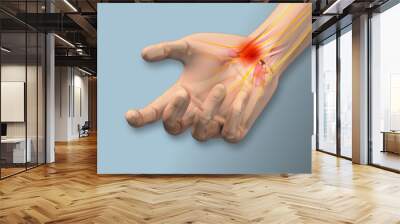  Carpal tunnel syndrome pain, numbness,tingling  Wall mural