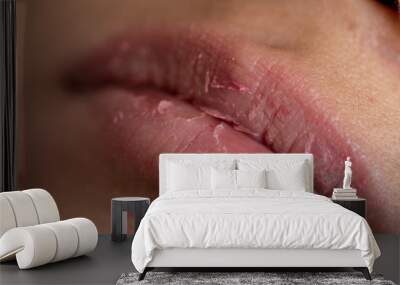 Backgrounds of Dry lips in the clinic. Wall mural