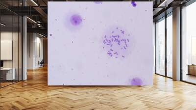 Chromosomes Human under the microscope for education. Wall mural