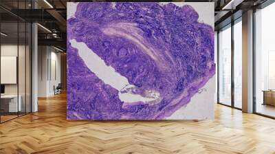 Pathology and Histology Tissue of Mammals under microscope. Wall mural