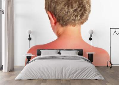 Sunburn on a child's back Wall mural