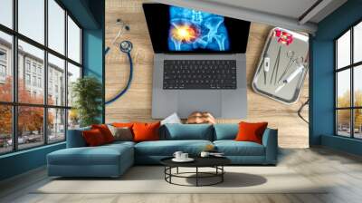 Top view of doctor looking a x-ray of pain in the hips on a laptop.  Wall mural