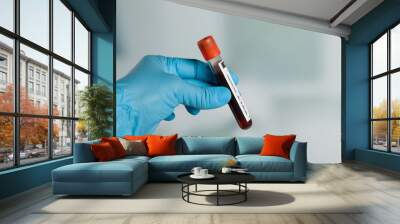 Doctor's hand with medical glove holding a blood probe in front of a lab Wall mural