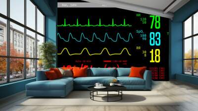 Monitoring of patient's condition, vital signs on ICU monitor in hospital. 3D illustration Wall mural