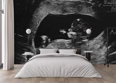 Pregnant baby infant ultrasound display. Mother belly screen in hospital. Womb scan Wall mural