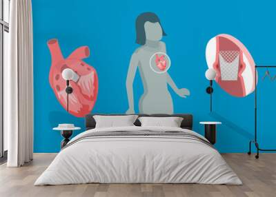 3D Isometric Flat Vector Conceptual Illustration of Transcutaneous Aortic Valve Replacement - TAVR, Minimally Invasive Surgery Wall mural