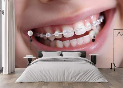 Close-up of a happy child's smile with healthy white teeth with metal braces on a white background. Children's dentistry concept Wall mural