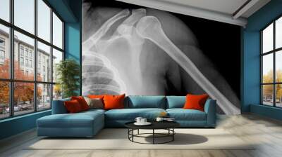 x-ray of shoulder joint / many others x-ray images in my portfolio. Wall mural