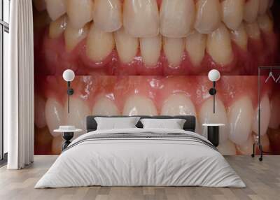 Before and After Dental smile makeover Wall mural