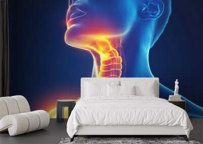 Medical illustration of acid reflux affecting the esophagus, showing irritation and inflammation from stomach acid Wall mural