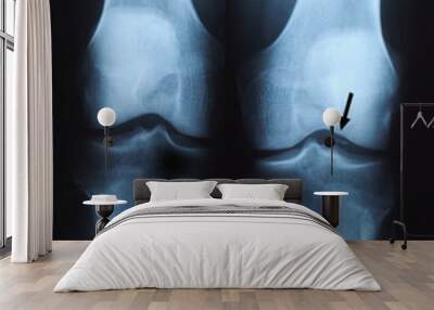 x ray photo of human knee Wall mural