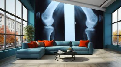 x ray photo of human knee Wall mural