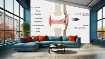 Rheumatoid arthritis, osteoarthritis of the joint. Images of healthy and diseased joints with main parts labeled, isolated on white, Vector, illustration, comparison, healthy joint, and arthritis. Wall mural