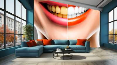 Woman's teeth before and after teethpaste makeover. Generative AI. Wall mural