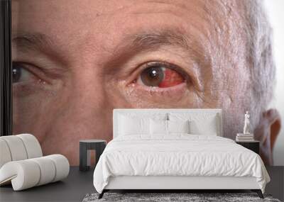 Senior man with irritated red bloodshot eye Wall mural