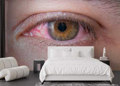 Macro of conjunctivitis red eye. Wall mural