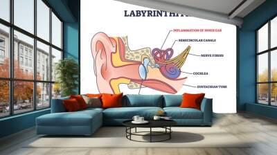 Labyrinthitis as inner ear infection and medical inflammation outline diagram. Labeled educational scheme with painful condition and medical cause for hearing and balance loss vector illustration. Wall mural