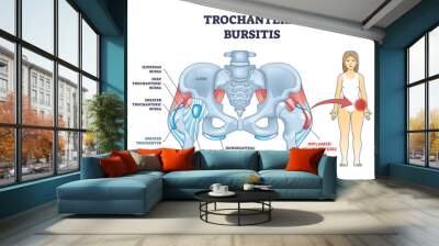 Trochanteric bursitis as bursa inflammation located in hip outline diagram. Labeled educational medical anatomy scheme with iliopsoas and deep greater trochanteric bursa types vector illustration. Wall mural