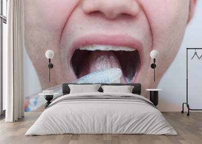  cleaning the tongue with toothpaste. diseases of the larynx. Wall mural