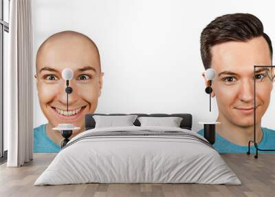 bald man before and after transplant hair and alopecia. Isolated on white background. Wall mural