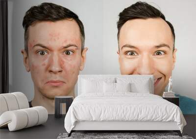 two guys before-after: left guy with acne, red spots, problem skin, right guy with healthy skin. Acne treatment concept Wall mural