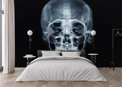 X-ray of the human head and brain. Neurological picture of human skull Wall mural