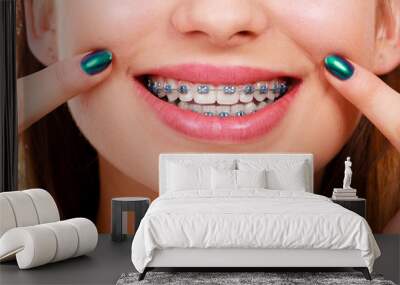 Woman showing her teeth with braces Wall mural