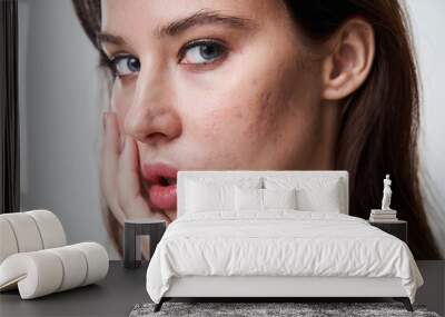 Woman with with post acne spots at her face looking at the camera Wall mural