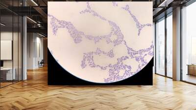 Microbiological fixed preparation of lactic acid bacteria of bacillary form stained with gentian violet Wall mural